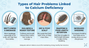 Types of Hair Problems Linked to Calcium Deficiency